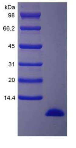 Novus Biologicals&trade;&nbsp;Recombinant Human IGF-I/IGF-1 15N Stable Isotope Protein