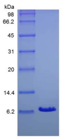 Novus Biologicals Recombinant Human IGF-I/IGF-1 Protein 500 &mu;g | Buy Online | Novus Biologicals&trade; | Fisher Scientific
