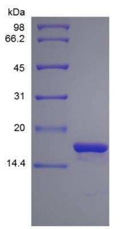 Novus Biologicals Recombinant Human IL-1 alpha/IL-1F1 Protein 1 mg | Buy Online | Novus Biologicals&trade; | Fisher Scientific