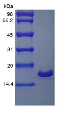 Novus Biologicals Recombinant Human IL-1 beta/IL-1F2 Protein 500 &mu;g | Buy Online | Novus Biologicals&trade; | Fisher Scientific