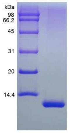 Novus Biologicals Recombinant Human IL-13 Protein 100 &mu;g | Buy Online | Novus Biologicals&trade; | Fisher Scientific