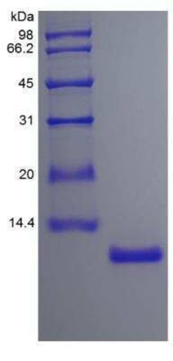 Novus Biologicals Recombinant Human IL-15 Protein 1 mg | Buy Online | Novus Biologicals&trade; | Fisher Scientific