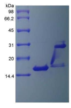 Novus Biologicals Recombinant Human IL-17/IL-17A Protein 1 mg | Buy Online | Novus Biologicals&trade; | Fisher Scientific