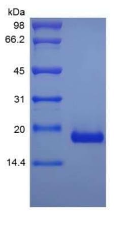 Novus Biologicals Recombinant Human IL-17B Protein 5 &mu;g | Buy Online | Novus Biologicals&trade; | Fisher Scientific