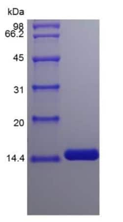 Novus Biologicals Recombinant Human IL-2 Protein 100 &mu;g | Buy Online | Novus Biologicals&trade; | Fisher Scientific