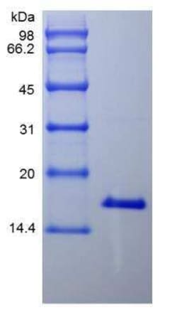 Novus Biologicals Recombinant Human IL-21 Protein 500 &mu;g | Buy Online | Novus Biologicals&trade; | Fisher Scientific