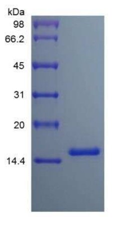 Novus Biologicals Recombinant Human IL-3 Protein 100 &mu;g | Buy Online | Novus Biologicals&trade; | Fisher Scientific