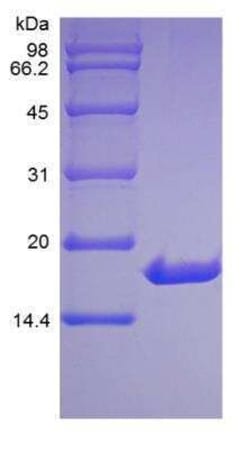 Novus Biologicals Recombinant Human IL-33 Protein 500 &mu;g | Buy Online | Novus Biologicals&trade; | Fisher Scientific