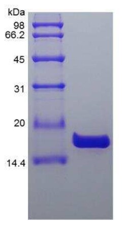 Novus Biologicals Recombinant Human IL-36 beta/IL-1F8 Protein 1 mg | Buy Online | Novus Biologicals&trade; | Fisher Scientific