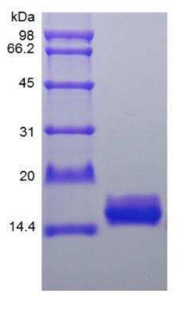 Novus Biologicals Recombinant Human IL-36Ra/IL-1F5 Protein 1 mg | Buy Online | Novus Biologicals&trade; | Fisher Scientific