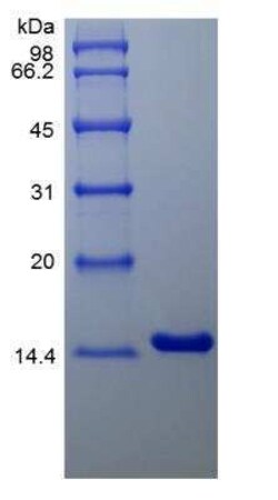 Novus Biologicals Recombinant Human IL-4 Protein 100 &mu;g | Buy Online | Novus Biologicals&trade; | Fisher Scientific