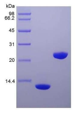 Novus Biologicals Recombinant Human IL-5 Protein 1 mg | Buy Online | Novus Biologicals&trade; | Fisher Scientific