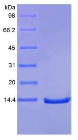 Novus Biologicals Recombinant Human IL-9 Protein 10 &mu;g | Buy Online | Novus Biologicals&trade; | Fisher Scientific