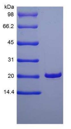 Novus Biologicals Recombinant Human KGF/FGF-7 Protein 1 mg | Buy Online | Novus Biologicals&trade; | Fisher Scientific