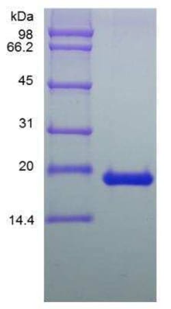 Novus Biologicals Recombinant Human LIF Protein 1 mg | Buy Online | Novus Biologicals&trade; | Fisher Scientific