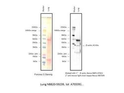 Novus Biologicals™ Human Lung Whole Tissue Lysate (Adult Whole Normal)
