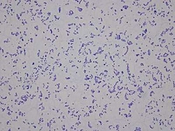 Novus Biologicals Human MCF-7 Cell Line Slides (Tumor)- Paraffin 5 Slides | Buy Online | Novus Biologicals&trade; | Fisher Scientific