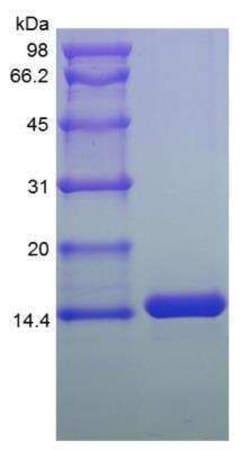 Novus Biologicals Recombinant Human MIA2 Protein 1 mg | Buy Online | Novus Biologicals&trade; | Fisher Scientific