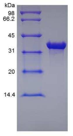 Novus Biologicals Recombinant Human MICA Protein 10 &mu;g | Buy Online | Novus Biologicals&trade; | Fisher Scientific