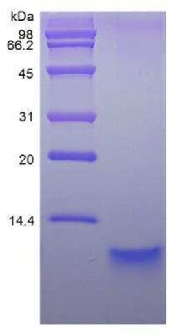 Novus Biologicals Recombinant Human NRG1 beta2 Protein 500 &mu;g | Buy Online | Novus Biologicals&trade; | Fisher Scientific