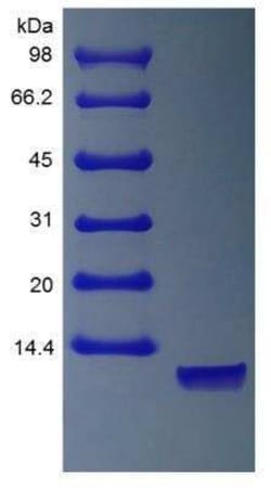 Novus Biologicals Recombinant Human Neuregulin-1 alpha/NRG1 alpha Protein 1000 &mu;g | Buy Online | Novus Biologicals&trade; | Fisher Scientific