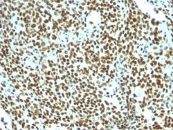 Nuclear Antigen Antibody (NM106), Novus Biologicals 0.2 mg | Buy Online | Novus Biologicals | Fisher Scientific