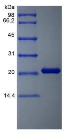 Novus Biologicals Recombinant Human Oncostatin M/OSM Protein 10 &mu;g | Buy Online | Novus Biologicals&trade; | Fisher Scientific