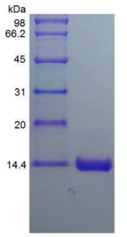 Novus Biologicals Recombinant Human Otoraplin/OTOR Protein 100 &mu;g | Buy Online | Novus Biologicals&trade; | Fisher Scientific