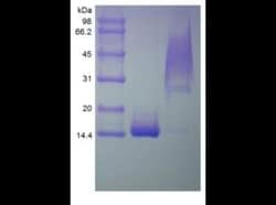 Novus Biologicals Recombinant Human PDGF-BB Protein 1 mg | Buy Online | Novus Biologicals&trade; | Fisher Scientific