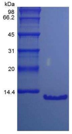 Novus Biologicals Recombinant Human PTH 15N Stable Isotope Protein 1000 &mu;g | Buy Online | Novus Biologicals&trade; | Fisher Scientific
