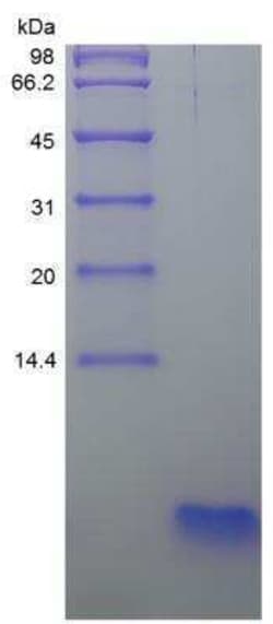 Novus Biologicals Recombinant Human PTH Protein 1000 &mu;g | Buy Online | Novus Biologicals&trade; | Fisher Scientific