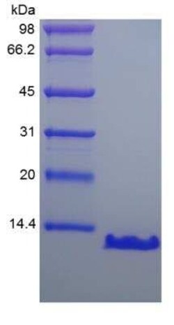 Novus Biologicals Recombinant Human PTH Protein 1000 &mu;g | Buy Online | Novus Biologicals&trade; | Fisher Scientific