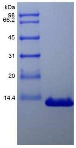 Novus Biologicals Recombinant Human PTHLH/PTHrP Protein 1mg | Buy Online | Novus Biologicals&trade; | Fisher Scientific