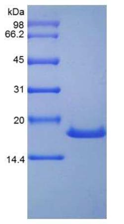 Novus Biologicals Recombinant Human SCF/c-kit Ligand Protein 10 &mu;g | Buy Online | Novus Biologicals&trade; | Fisher Scientific