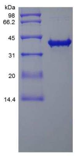 Novus Biologicals Recombinant Human SOX2 TAT Protein 1 mg | Buy Online | Novus Biologicals&trade; | Fisher Scientific