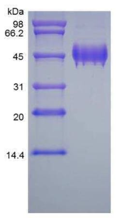 Novus Biologicals Recombinant Human Serpin F1/PEDF Protein 500 &mu;g | Buy Online | Novus Biologicals&trade; | Fisher Scientific