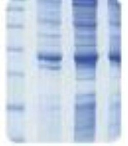 Novus Biologicals Human Skin Whole Tissue Lysate (Adult Whole Normal) 1 mg | Buy Online | Novus Biologicals&trade; | Fisher Scientific