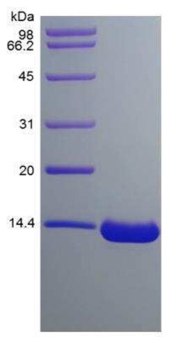 Novus Biologicals Recombinant Human TAFA2/FAM19A2 Protein 1 mg | Buy Online | Novus Biologicals&trade; | Fisher Scientific