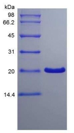Novus Biologicals Recombinant Human TFF1/pS2 Protein 100 &mu;g | Buy Online | Novus Biologicals&trade; | Fisher Scientific