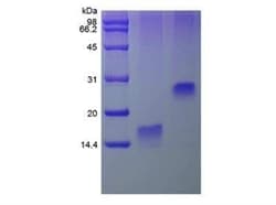 Novus Biologicals Recombinant Human TFF3 Protein 1 mg | Buy Online | Novus Biologicals&trade; | Fisher Scientific