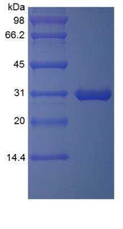Novus Biologicals Recombinant Human TIGAR/C12orf5 TAT Protein 5 &mu;g | Buy Online | Novus Biologicals&trade; | Fisher Scientific