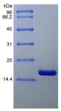 Novus Biologicals Recombinant Human TNF-alpha Protein 10 &mu;g | Buy Online | Novus Biologicals&trade; | Fisher Scientific