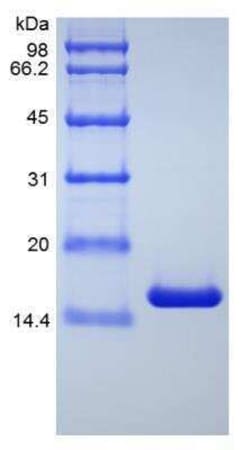 Novus Biologicals Recombinant Human TNF-alpha Variant Protein 1 mg | Buy Online | Novus Biologicals&trade; | Fisher Scientific
