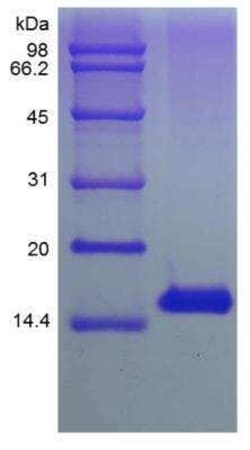 Novus Biologicals Recombinant Human TSLP Protein 500 &mu;g | Buy Online | Novus Biologicals&trade; | Fisher Scientific