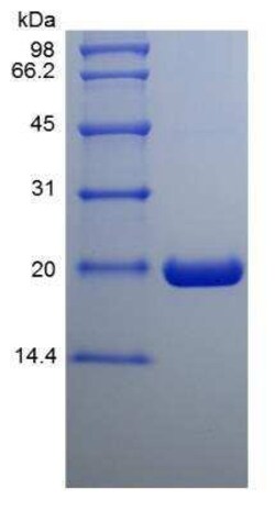 Novus Biologicals Recombinant Human UbcH10/UBE2C His (N-Term) Protein 500 &mu;g | Buy Online | Novus Biologicals&trade; | Fisher Scientific