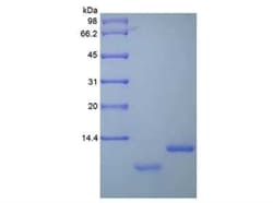 Novus Biologicals Recombinant Human Uteroglobin/SCGB1A1 Protein 10 &mu;g | Buy Online | Novus Biologicals&trade; | Fisher Scientific