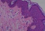 Thumbnail_Novus Biologicals Human Multi-tissue Tissue MicroArray (Cancer) Human Ovary