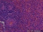 Thumbnail_Novus Biologicals Human Multi-tissue Tissue MicroArray (Cancer) Human Ovary