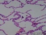 Thumbnail_Novus Biologicals Human Multi-tissue Tissue MicroArray (Cancer) Human Ovary