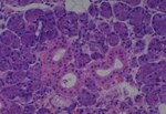Thumbnail_Novus Biologicals Human Multi-tissue Tissue MicroArray (Cancer) Human Ovary
